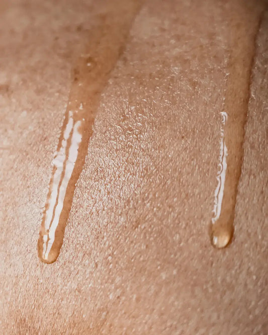 Vergetures-comprendre-prévenir-et-apaiser-naturellement-à-chaque-étape-de-la-vie J'olie Marie